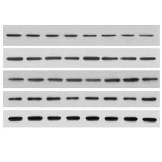 蛋白質免疫印跡(Western Blot, WB )